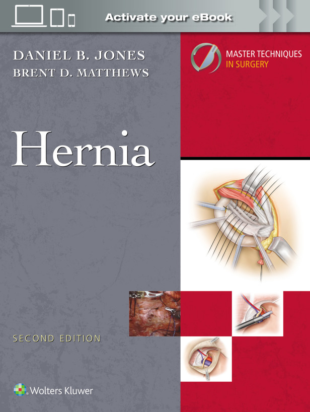 MASTER TECHNIQUES IN SURGERY : HERNIA 2ND EDITION
