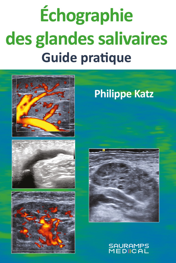 ECHOGRAPHIE DES GLANDES SALIVAIRES- GUIDE PRATIQUE