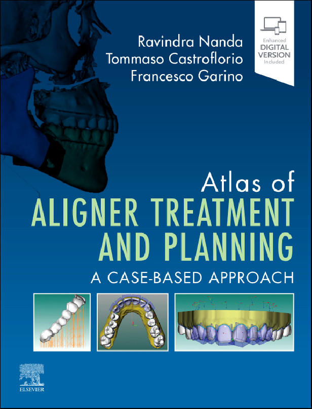 ATLAS OF ALIGNER TREATMENT AND PLANNING