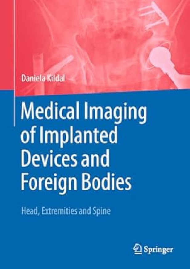 MEDICAL IMAGING OF IMPLANTED DEVICES AND FOREIGN BODIES %3B HEAD, EXTREMITIES AND SPINE