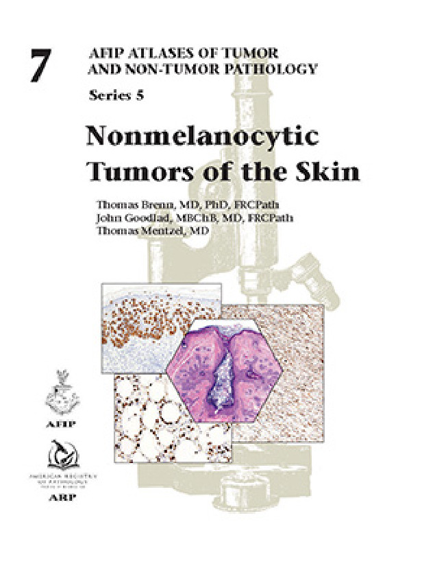 NONMELANOCYTIC TUMORS OF THE SKIN - AFIP N? 7 SERIE 5