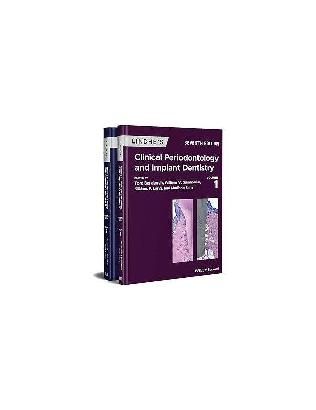 LINDHE''S CLINICAL PERIODONTOLOGY AND IMPLANT DENTISTRY, 2 VOLUME SET
