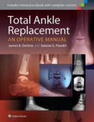 TOTAL ANKLE REPLACEMENT