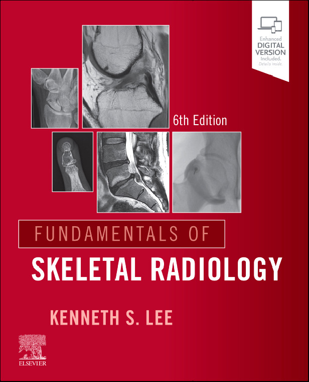 FUNDAMENTALS OF SKELETAL RADIOLOGY 6TH EDITION