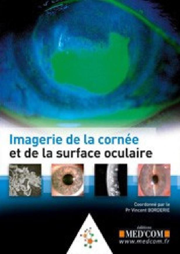IMAGERIE DE LA CORNEE ET DE LA SURFACE OCULAIRE