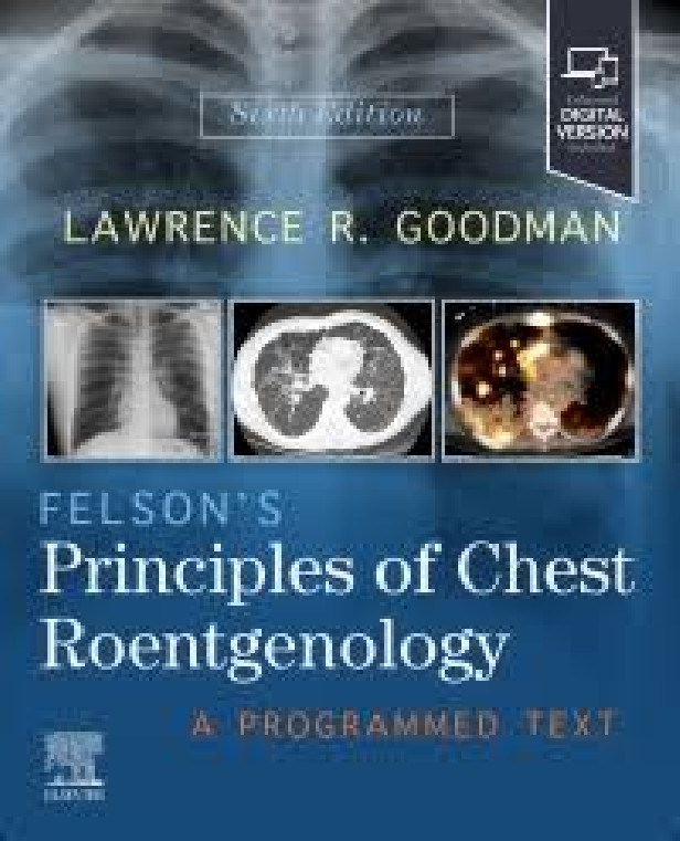 FELSON'S PRINCIPLES OF CHEST ROENTGENOLOGY 6TH EDITION