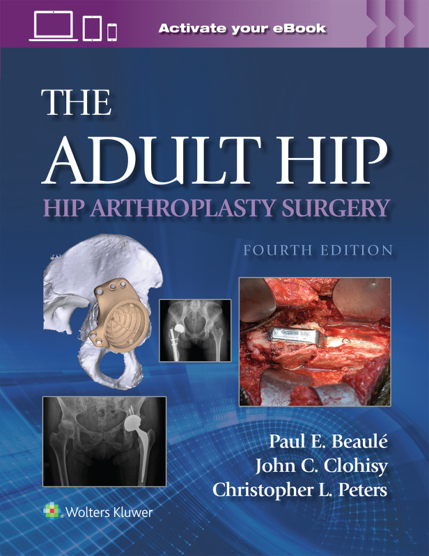 THE ADULT HIP : HIP ARTHROPLASTY SURGERY 4TH EDITION