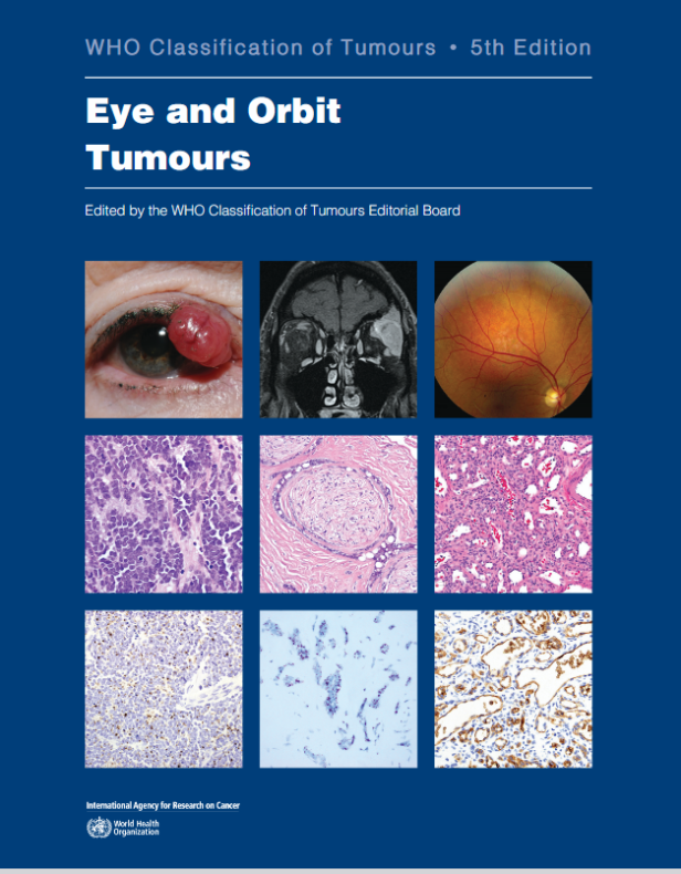 WHO CLASSIFICATION OF EYE AND ORBIT TUMOURS 5TH EDITION - VOLUME 13