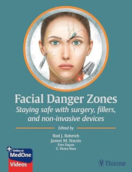 Facial danger zones