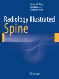 Radiology illustrated spine