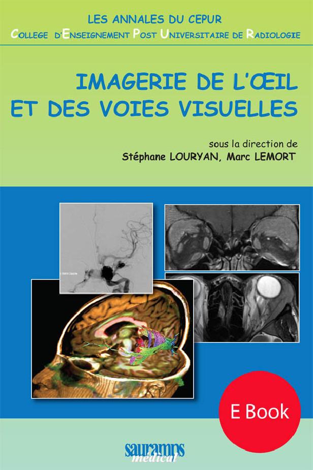 EBOOK ANNALES DU CEPUR IMAGERIE DE L'OEIL ET DES VOIES VISUELLES