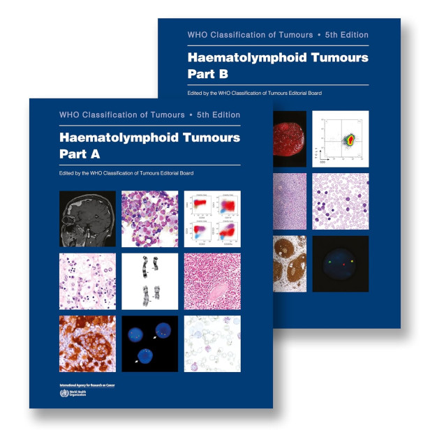 HAEMATOLYMPHOID TUMOURS - WHO CLASSIFICATION OF TUMOURS 5TH ED VOL 11