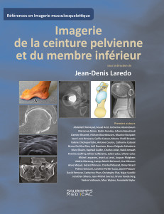 Imagerie de la ceinture pelvienne et du membre inferieur