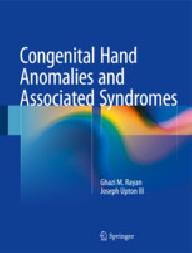 CONGENITAL HAND ANOMALIES...