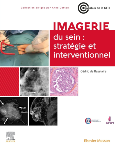 IMAGERIE DU SEIN : STRATEGIE ET INTERVENTIONNEL