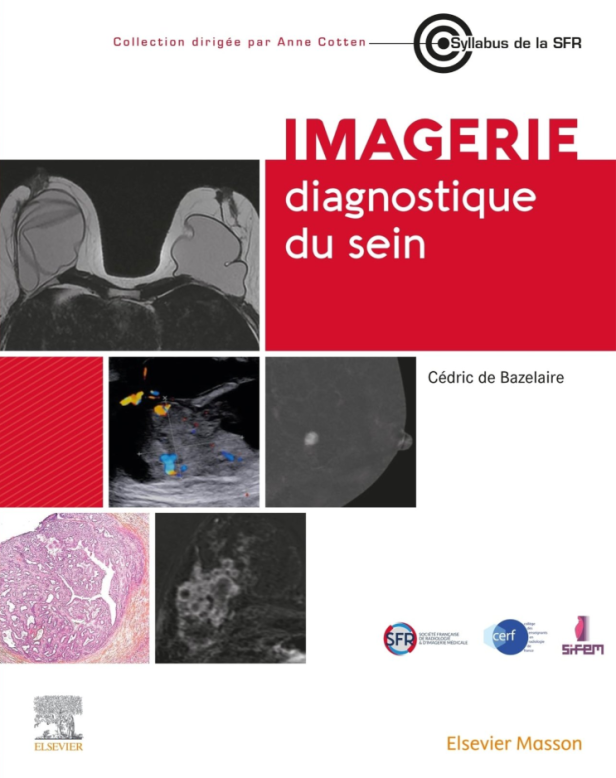 IMAGERIE DIAGNOSTIQUE DU SEIN