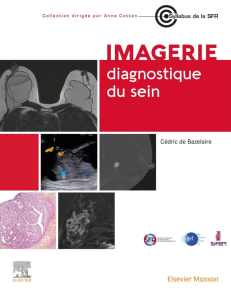 IMAGERIE DIAGNOSTIQUE DU SEIN