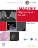Imagerie diagnostique du sein