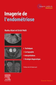 IMAGERIE DE L'ENDOMETRIOSE