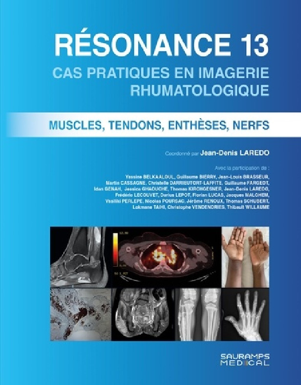 RESONANCE 13- CAS PRATIQUES EN IMAGERIE RHUMATOLOGIQE - MUSCLES TENONS, ENTHESES, NERFS