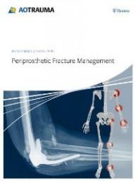 PERIPROSTHETIC FRACTURE...