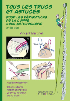 Tous les trucs et astuces pour les reparations de la coiffe sous arthroscopie