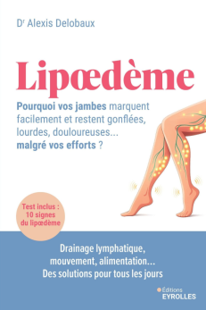 LIPOEDEME : POURQUOI VOS JAMBES MARQUENT FACILEMENT ET RESTENT GONFLEES, LOURDES, DOULOUREUSES... MA