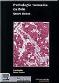 Pathologie tumorale du foie